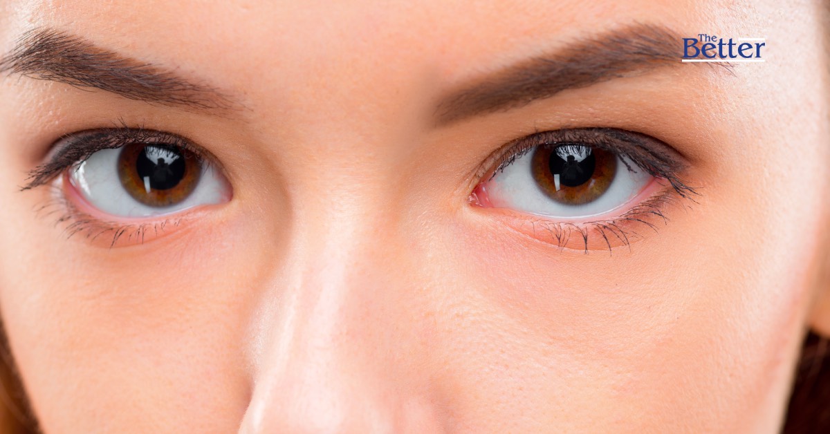 เตือน! กินของดิบๆ ทำพยาธิขึ้นตา ตาบอดได้